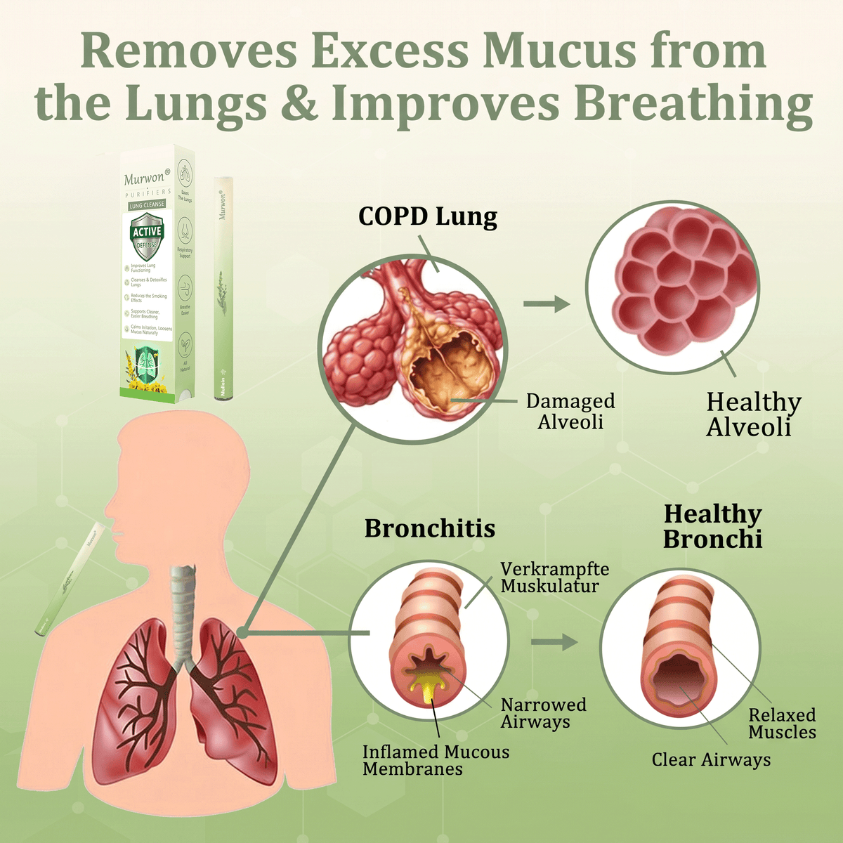 𝙊𝙛𝙛𝙞𝒄𝒊𝒂𝒍 𝑺𝒕𝒐𝒓𝒆✅𝐌𝐮𝐫𝐰𝒐𝒏® 𝐁𝐨𝐭𝐚𝐧𝐢𝐜𝐚𝐥 𝐌𝐮𝐥𝐥𝐞𝐢𝐧 𝐋𝐮𝐧𝐠 𝐂𝐥𝐞𝐚𝐧𝐬𝐞 𝐃𝐢𝐟𝐟𝐮𝐬𝐞𝐫🔥(👨‍⚕️Cough, Pharyngitis, shortness of breath, sputum, stuffy nose, bronchitis, bronchitis, allergy symptoms, lung discomfort)2💖
