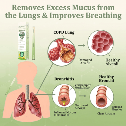𝙊𝙛𝙛𝙞𝒄𝒊𝒂𝒍 𝑺𝒕𝒐𝒓𝒆✅𝐌𝐮𝐫𝐰𝒐𝒏® 𝐁𝐨𝐭𝐚𝐧𝐢𝐜𝐚𝐥 𝐌𝐮𝐥𝐥𝐞𝐢𝐧 𝐋𝐮𝐧𝐠 𝐂𝐥𝐞𝐚𝐧𝐬𝐞 𝐃𝐢𝐟𝐟𝐮𝐬𝐞𝐫🔥(👨‍⚕️Cough, Pharyngitis, shortness of breath, sputum, stuffy nose, bronchitis, bronchitis, allergy symptoms, lung discomfort)2💖