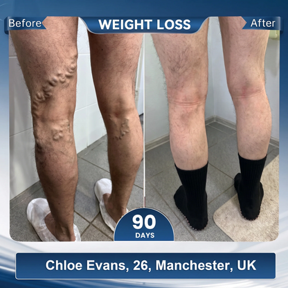 𝐅𝐥𝐚𝐠𝐬𝐡𝐢𝐩 𝐒𝐭𝐨𝐫𝐞 🎗️ 𝑩𝑳𝑼𝑬𝙎𝙃𝓞𝑻® 👑 𝟐𝟎𝟐𝟔  10 𝒊𝒏 1  𝑴𝑶𝑹𝙄𝙉𝙂𝘼 & 𝗕𝗘𝗥𝗕𝐄𝐑𝐈𝐍𝐄 𝗠𝗶𝗰𝒓𝒐-𝑷𝒂𝒓𝒕𝒊𝒄𝐥𝐞 𝐒𝐜𝐮𝐥𝐩𝐭𝐢𝐧𝐠 𝐬𝐨𝐜𝐤𝐬|𝐁𝐮𝐫𝐧 𝐟𝐚𝐭, 𝐬𝐡𝐚𝐩𝐞, 𝐩𝐫𝒐𝒎𝒐𝒕𝒆 𝒃𝒍𝒐𝒐𝒅 𝒄𝒊𝒓𝒄𝒖𝒍𝒂𝒕𝒊𝒐𝒏 𝒂𝒏𝒅 𝒎𝒆𝒕𝒂𝒃𝒐𝒍𝒊𝒔𝒎, 𝒖𝒏𝒄𝒍𝒐𝒈 𝒍𝒚𝒎𝒑𝒉 𝒏𝒐𝒅𝒆𝒔|𝑺𝒆𝒆 𝒓𝒆𝒔𝒖𝒍𝒕𝒔 𝒊𝒏 7 𝒅𝒂𝒚𝒔