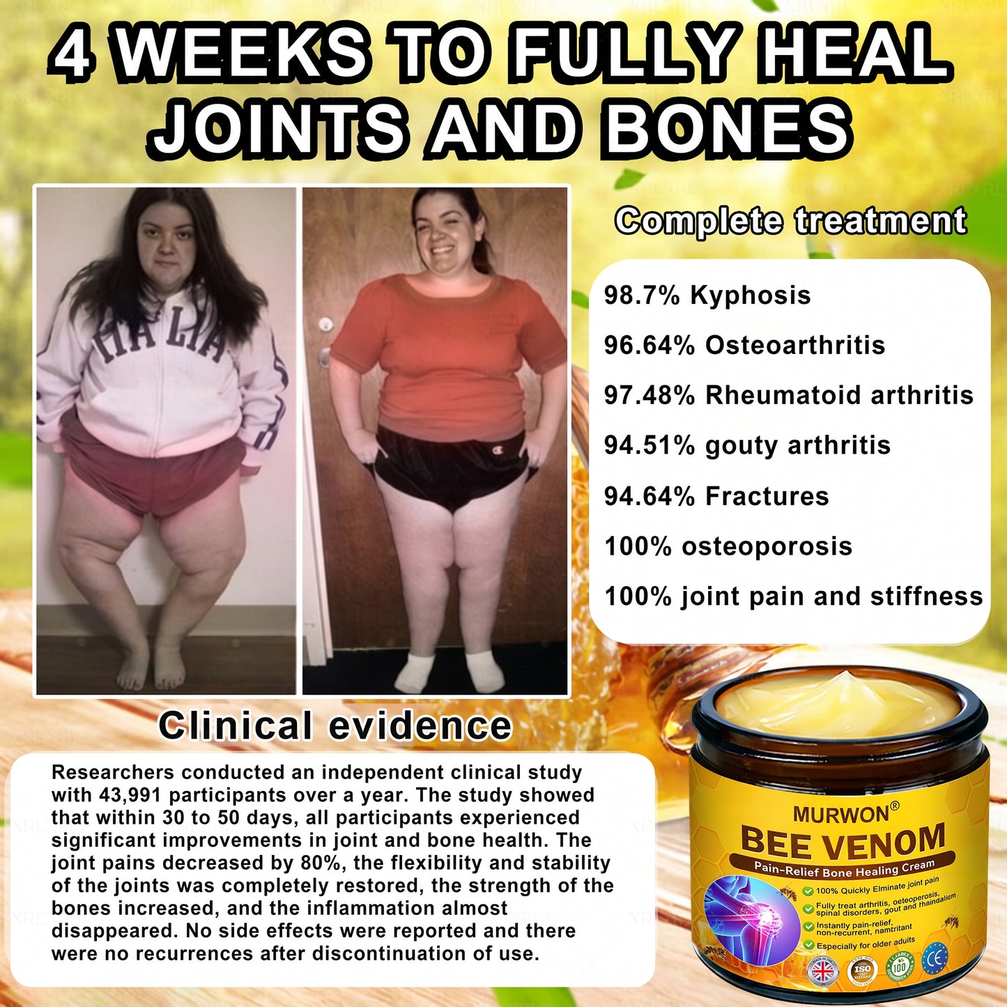 30% Discount🎁🎁|𝐌𝐔𝐑𝐖𝐎𝐍® Bee Venom Pain-Relief Bone Healing Cream ✨✨✨(Specially for older adults)